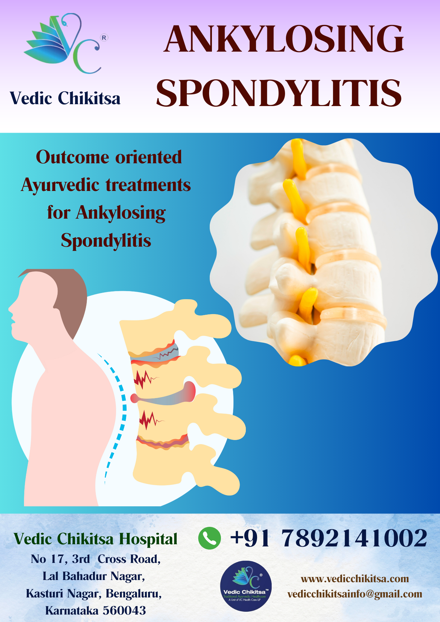 Vedic Chikitsa - Latest update - Ankylosing Spondylitis Ayurvedic Treatment in Bangalore