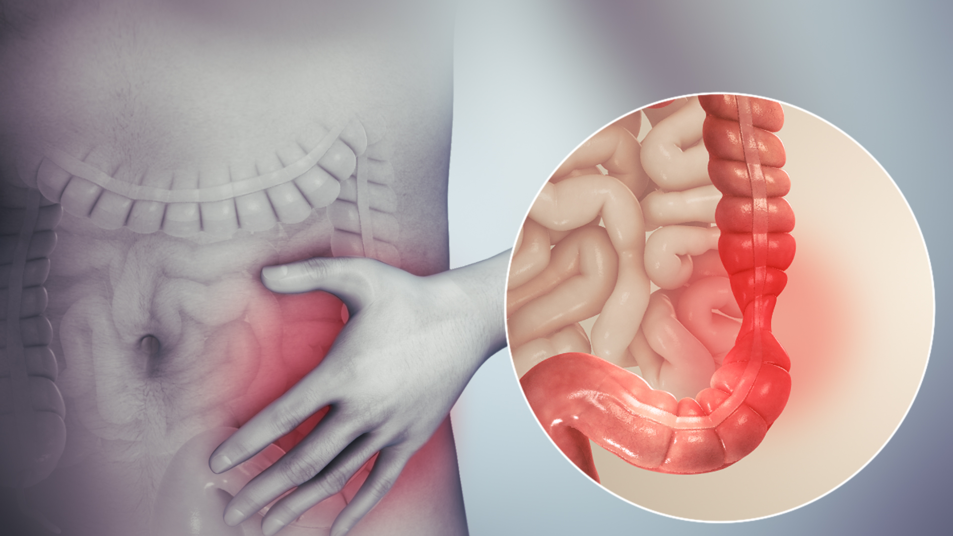 Vedic Chikitsa - Latest update - Irritable Bowel Syndrome Treatment in Ramamurthy Nagar