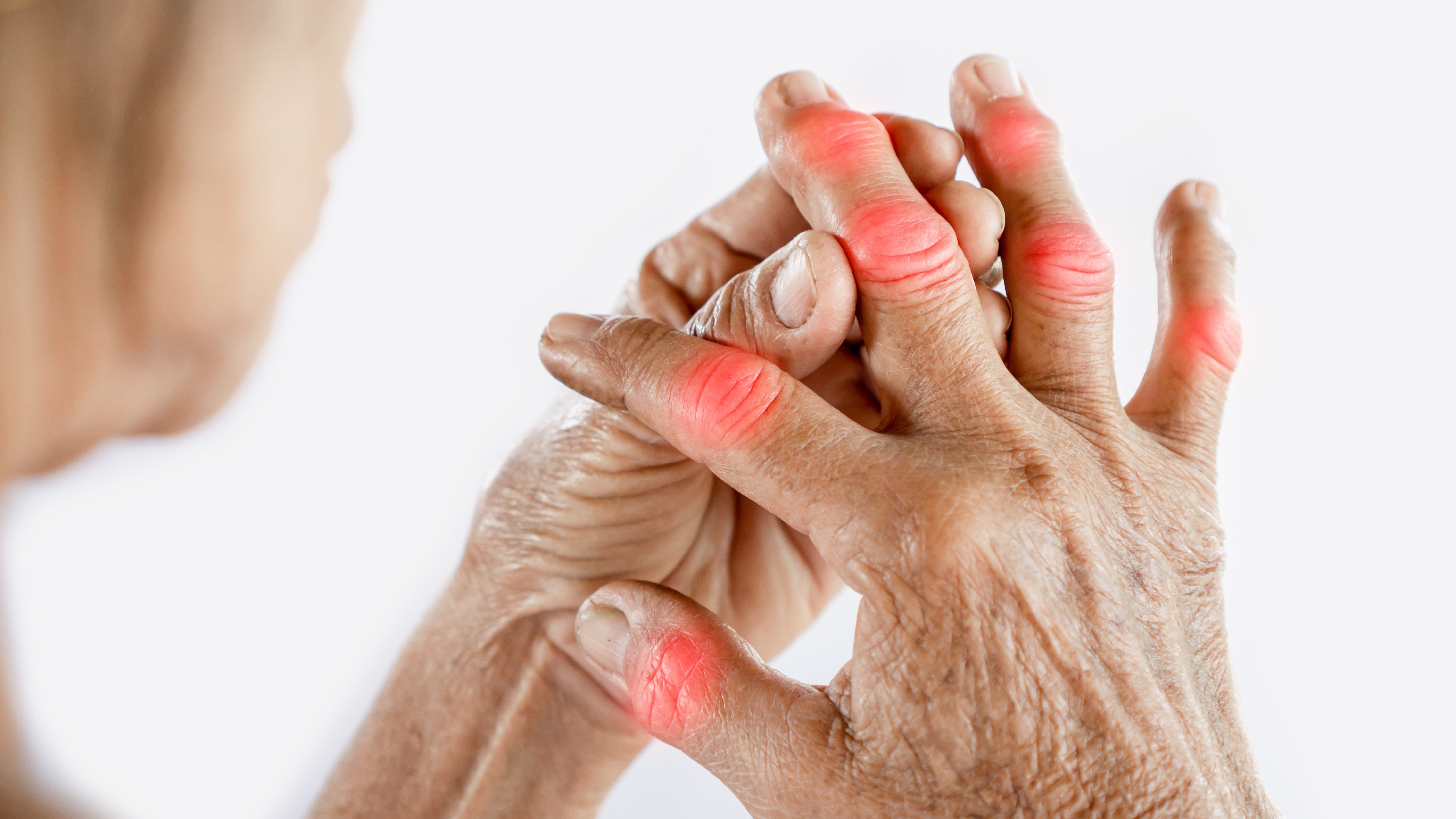 Vedic Chikitsa - Latest update - Rheumatoid Arthritis Treatment Near HRBR Layout