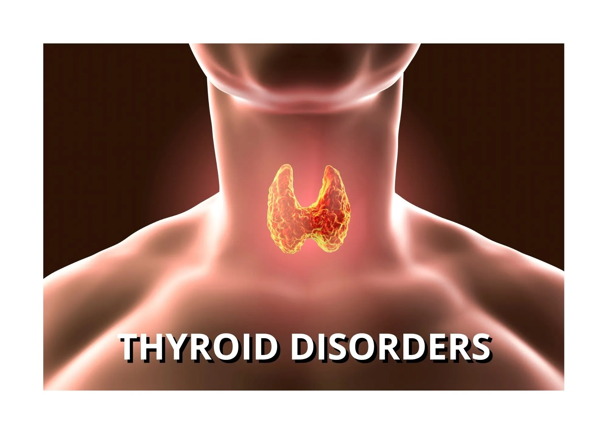 Vedic Chikitsa - Latest update - Thyroid Dysfunction Treatment in Bangalore