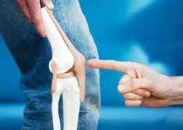 Vedic Chikitsa - Latest update - Osteoarthritis ayurvedic treatment in Ramamurthy Nagar