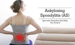 Vedic Chikitsa - Latest update - Spondylitis ayurvedic treatment in Ramamurthy Nagar